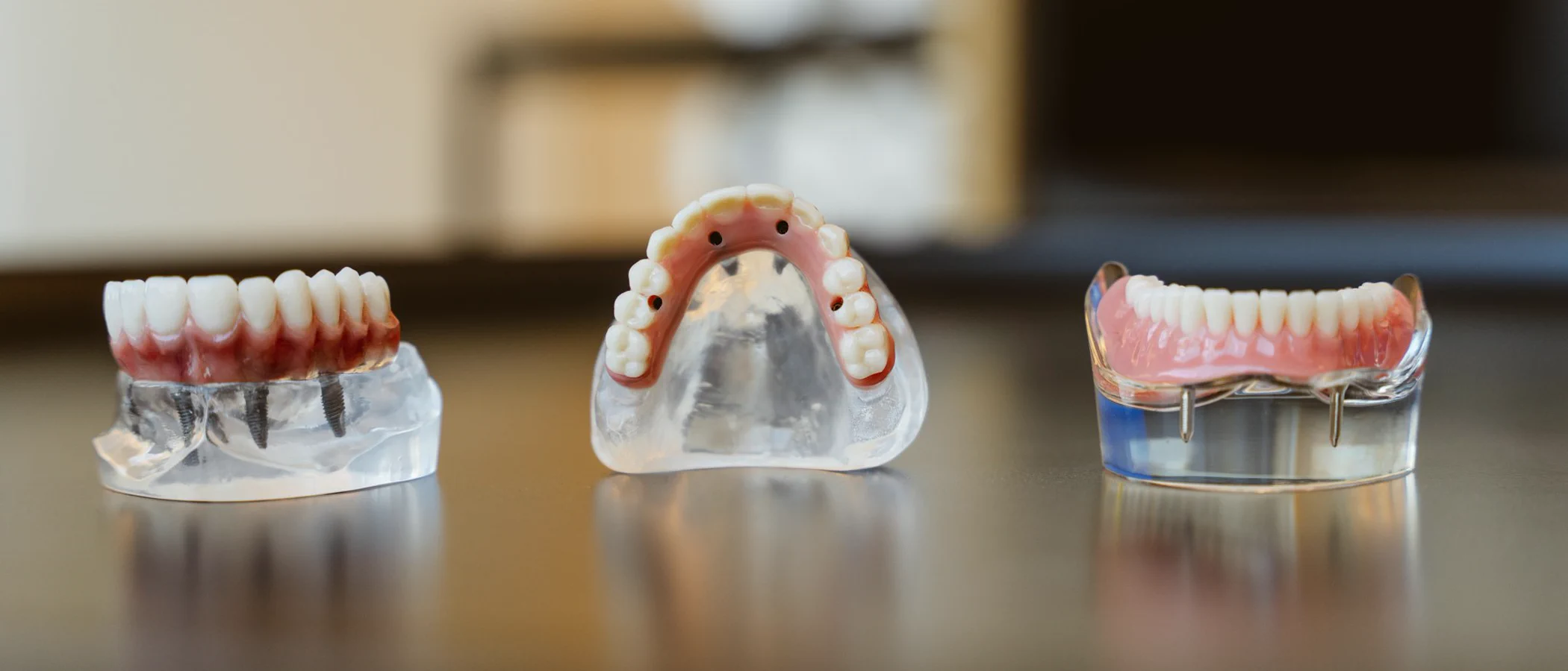 Three implant-supported dental models show different full-arch restoration designs.